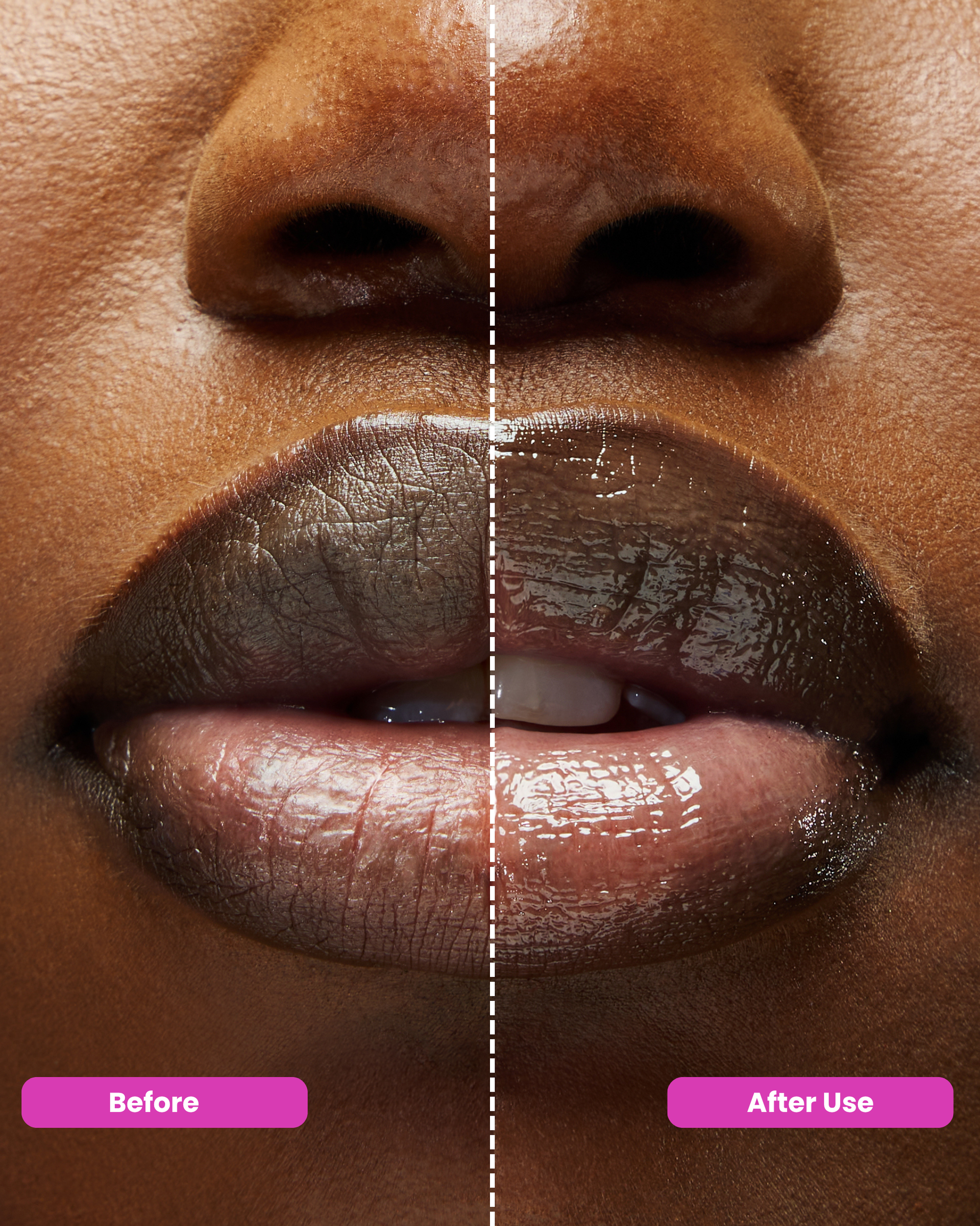 Overnight recovery for dry, sensitive lips